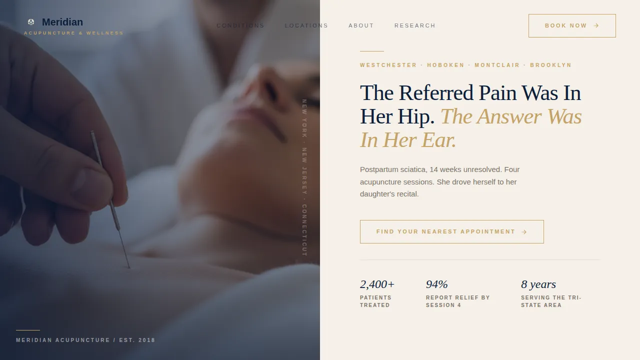 Acupoint — Proven Acupuncture Clinic Landing Page Template